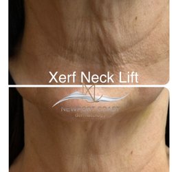 Newport Coast Dermatology