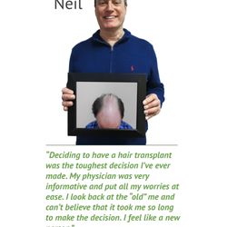 Ashley L Bohling, PA-C - LifeStyle Med - Hair Transplant Success
