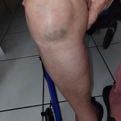 Professional Home Care - Nunca reportaron la caida..