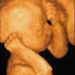 Baby's First Images - 3d ultrasound 4d ultrasound