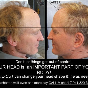 Michael Z Hair - So many things can change real fast!!! No surgery necessary!! It's a real game changer!! - Hair Stylists Near Me - Sarasota, Florida Michael Z Hair - So many things can change real fast!!! No surgery necessary!! It's a real game changer!! - Hair Stylists Near Me - Sarasota, Florida