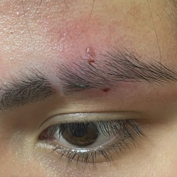 Steel Rod Tattoo - You can see the original healed top hole mark above where the new piercing was placed. - Tattoo Near Me - Indianapolis, Indiana Steel Rod Tattoo - You can see the original healed top hole mark above where the new piercing was placed. - Tattoo Near Me - Indianapolis, Indiana