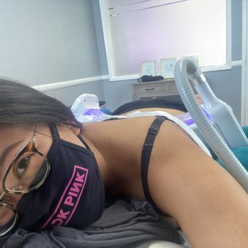 Sculpt Aesthetics Med Spa - Goodbye back fat! - Medical Spas Near Me - Seal Beach, California
