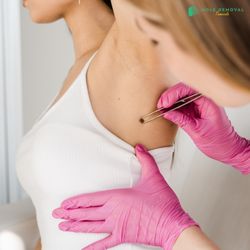 Mole Removal Temecula