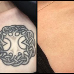 Sonic Tattoo