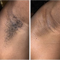 Golden Belle Waxing - Quick Underarm Wax