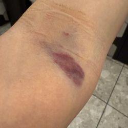 CSL Plasma - Inconsideration & Wrong Doing