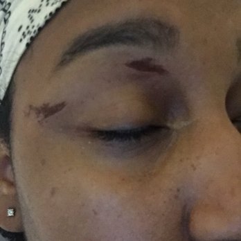 Rococo Sugaring & Spa - Scabs on my face only 24 hours after getting my brows waxed... Shape looks great but beware if you have sensitive skin. - Skin Care Near Me - Corona, California