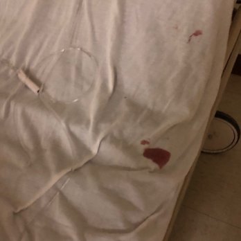 Midhudson Regional Hospital - My nurse "missed" while inserting the IV ( which dropped on the filthy floor). - Hospitals Near Me - Poughkeepsie, New York