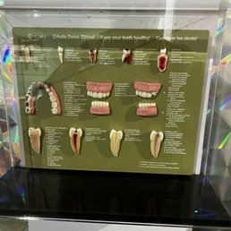 What could go wrong between those pearly whites? Learn more at the science spectrum.