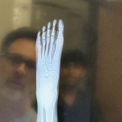 Austin Podiatry - Foot X-ray