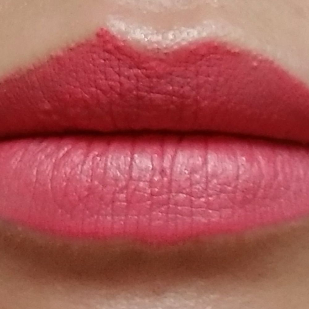 LIP Med Spa - After lip filler - Medical Spas Near Me - Austin, Texas