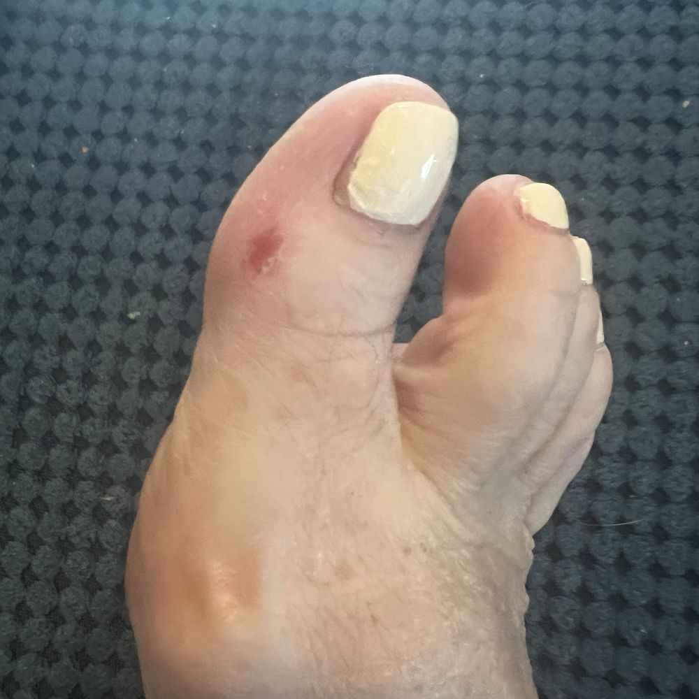 Poor polish on the edges, skin rubbed off.