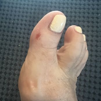 Glimmery Nails & Spa - Poor polish on the edges, skin rubbed off. - Nail Salons Near Me - Macomb Township, Michigan
