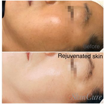 SkinCure - Skin Care Near Me - Santa Clara, California