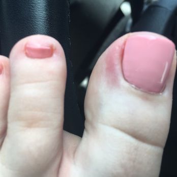 Soak Nails - OUCH! Cuticle was cut way too deep and now my toe is red and in pain! - Nail Salons Near Me - Encino, California