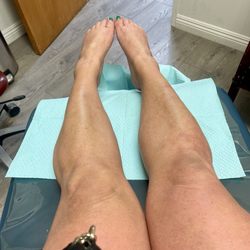 Bay Area Foot Care - My poor foot different view