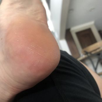 Cavalli Nails & Spa - Heel has scratches and rougher skin than when I went in! - Nail Salons Near Me - Katy, Texas