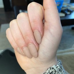 Dents and rivets in nails.