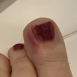 Tender Nails - Toe turned red a day after the pedicure.