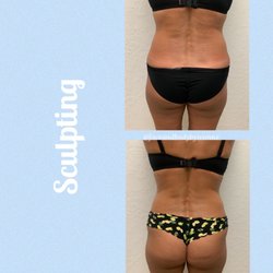 Bella Estetica - Sculpting Tummy, Waist & Back