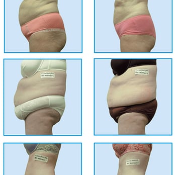 Yuri Prikoupenko, MD FACOG - i-Lipo Body Slimming and Laser Body Contouring - Obstetricians & Gynecologists Near Me - Bethesda, Maryland Yuri Prikoupenko, MD FACOG - i-Lipo Body Slimming and Laser Body Contouring - Obstetricians & Gynecologists Near Me - Bethesda, Maryland