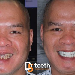 D5teeth - Chicago