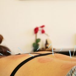 C3 Acupuncture