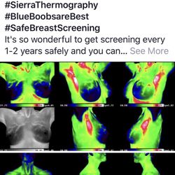 Sierra Thermography Center - My breast Thermography 2019. I will put frankincense and lavender and do lymph massage on the left red spot.