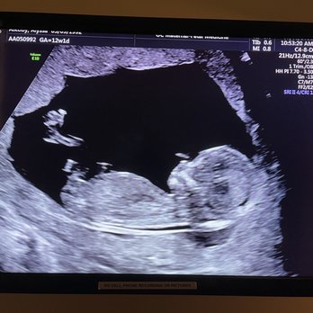 Jane Frederick, MD - Fertility Near Me - Newport Beach, California