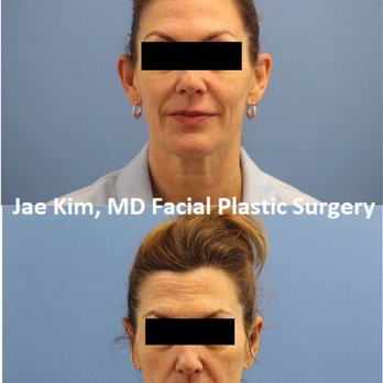 Jae Kim MD, Facial Plastic Surgery - Jae Kim, MD Facial Plastic Surgery - Plastic Surgeons Near Me - Fairfax, Virginia Jae Kim MD, Facial Plastic Surgery - Jae Kim, MD Facial Plastic Surgery - Plastic Surgeons Near Me - Fairfax, Virginia