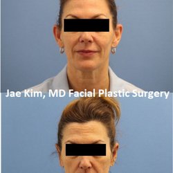 Jae Kim MD, Facial Plastic Surgery - Jae Kim, MD Facial Plastic Surgery