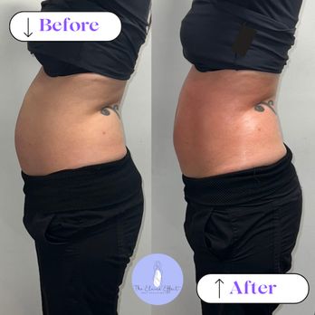 The Elaine Effect - Body Contouring Near Me The Elaine Effect - Body Contouring Near Me