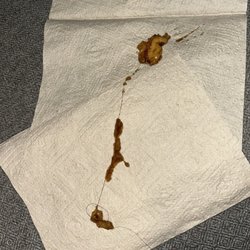 A Taste of Asia - The hair my son pulled out of the container