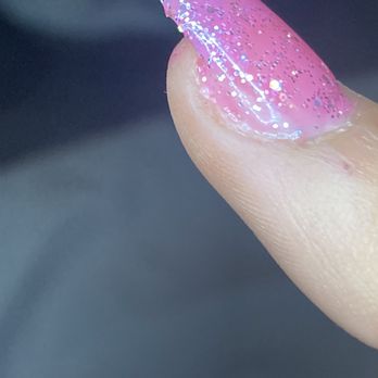 StarNailsBar - The nail the was dug into, that side is painted over with gel nail polish otherwise it would be much more noticeable - Nail Salons Near Me - Vista, California StarNailsBar - The nail the was dug into, that side is painted over with gel nail polish otherwise it would be much more noticeable - Nail Salons Near Me - Vista, California