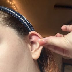 Bruise on ear from Kelsi and her HUGE pliers from my piercing.