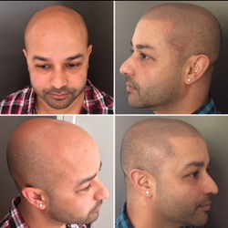 Scalp Authority
