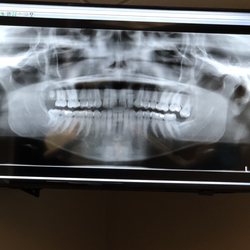 Alabama Oral & Facial Surgery - They have nice big TVs in the consultation room where the oral surgeon will show you your X-ray and walk you through the surgery plan.