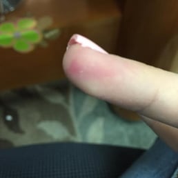 Left my old nail polish all over my finger