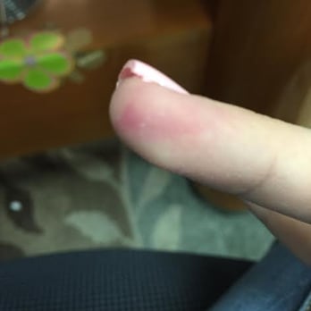 ProfessioNails - Left my old nail polish all over my finger - Nail Salons Near Me - Provo, Utah