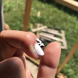 Infected nail day 1 Infected nail day 1