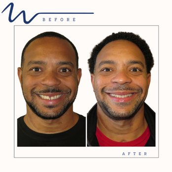 Williamsburg Orthodontics - Orthodontists Near Me - Williamsburg, Virginia Williamsburg Orthodontics - Orthodontists Near Me - Williamsburg, Virginia