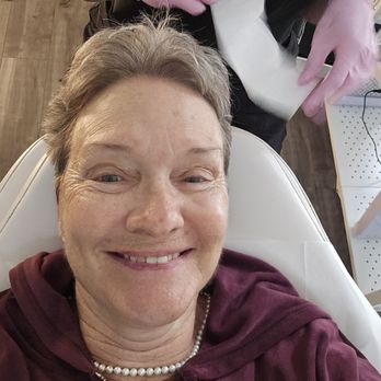 Contour Palace - Before and after Express facial! NO MAKEUP ON. i highly recommend this treatment! - Medical Spas Near Me - Rancho Cucamonga, California