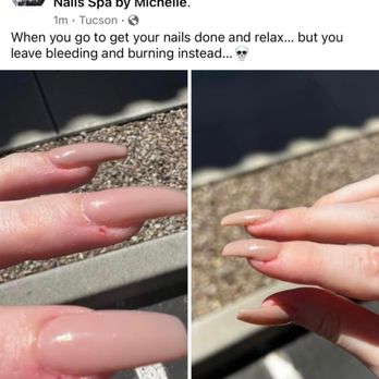 Delicate Nails - My post of bleeding - Nail Salons Near Me - Tucson, Arizona Delicate Nails - My post of bleeding - Nail Salons Near Me - Tucson, Arizona