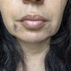 Gulf Coast Facial Plastics and ENT Center - After