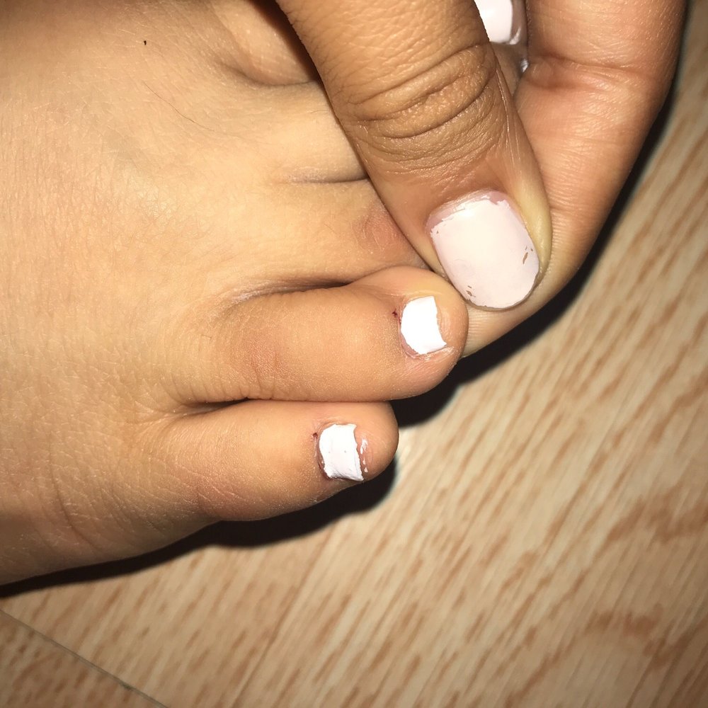 C & K Nails - The two dots are from the cuticle nipper - Nail Salons Near Me - Granger, Indiana C & K Nails - The two dots are from the cuticle nipper - Nail Salons Near Me - Granger, Indiana