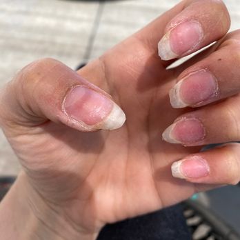 Pink Nail N Spa - Damaged nails from years of acrylics - Nail Salons Near Me - Elk Grove, California Pink Nail N Spa - Damaged nails from years of acrylics - Nail Salons Near Me - Elk Grove, California