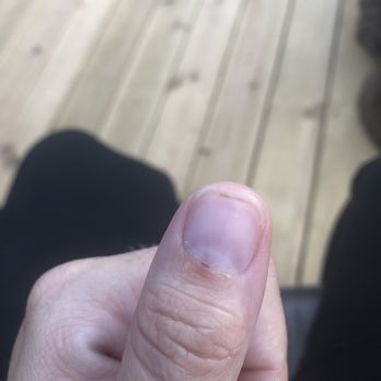 Passion Nails - Cut finger - Nail Salons Near Me - Broken Arrow, Oklahoma Passion Nails - Cut finger - Nail Salons Near Me - Broken Arrow, Oklahoma