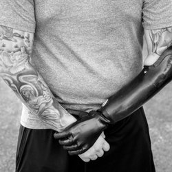 Human Designs Prosthetics And Orthotics - Contact us at (866) 988-2414 to learn more about the Human Designs team or to schedule a free consultation appointment!