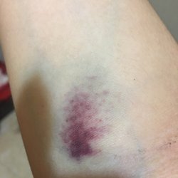 Yuqing Chen, MD